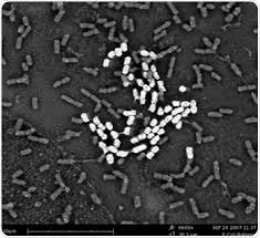 Flagella are produced at room temperature, but not at 37 °c. Studying Foodborne Pathogens Using Electron Microscopy