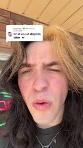 Understanding Dolphin Bites in Piercing Culture