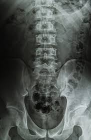 Image result for Low Back Imaging