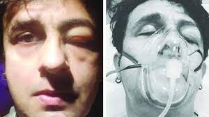 Are you aware of the sonu nigam age? Sonu Nigam Suffers Allergic Reaction To Seafood