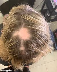 The jshealth hair + energy contains iodine from two high purity kelp materials which: Woman 47 Cures Her Frequent Hair Loss In Five Months With Just One Vitamin Express Digest