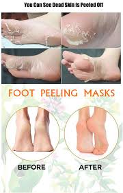 Foot Peeling Masks Peeling Mask Skin Moles Dead Skin