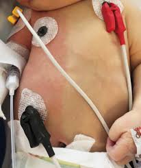 Image result for Harlequin Color Change