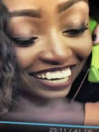 what's up w these front teeth : r/Floribama