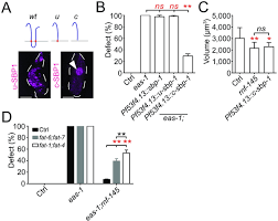 We did not find results for: Regulation Of Glial Size By Eicosapentaenoic Acid Through A Novel Golgi Apparatus Mechanism
