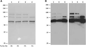 Image result for Black 1999 AAV