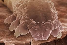 Image result for Demodex folliculorum