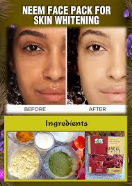 Instead of spending money on expensive and harsh chemical treatments, why not try these 13 common foods to help whiten your teeth naturally? Natural Beauty Tips For Detail Https Naturalbeautytipz Com Neem Face Pack For Skin Whitening Facebook