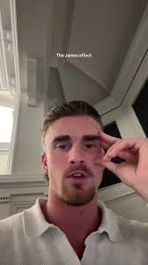 The James Effect Trend