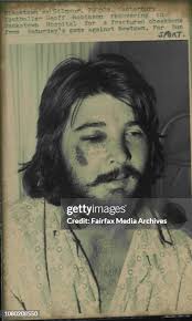 908 Cheek Bones Stock Photos, High-Res Pictures, and Images