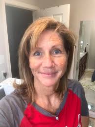 Hi, I am having more leads put in for more coverage in a couple of weeks  can anyone recommend anything that I should make sure I have for the  recovery at home?