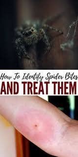 Identify The Deadly Spiders Of North America With Images Treating Spider Bites Spider Bites Bug Bites Remedies