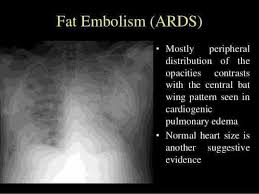 Pin On Respiratory
