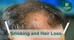 Also, it increases oxidative stress and associated hair damage (v). Does Smoking Cause Hair Loss Hair Loss Article Blogs