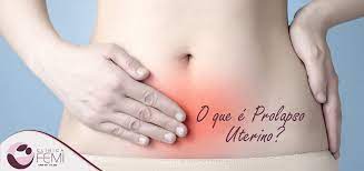 O Que E Prolapso Uterino Clinica Femi