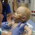Surgery delayed for Carter, one ofJacksonville'sformerly conjoined...