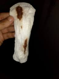 Manchado Marron 14 Dias De Retraso Apoyo Ayuda Y Consejos Durante El Embarazo Babycenter