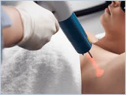 Our practitioners work with precision and care for beautiful, smooth skin. Laser Hair Removal Melbourne In Melbourne Vic Hair Removal Truelocal