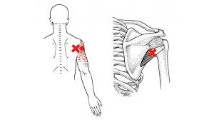 Image result for Tender Point