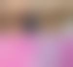 Image result for Perirectal Abscess