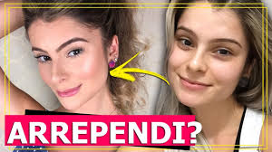 A bichectomia é a cirurgia plástica em que há a retirada parcial ou total de duas bolsas de gorduras presentes entre o maxilar e a mandíbula. Bichectomia 1 Ano Depois Valeu A Pena Youtube