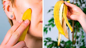 A lot of people love consuming bananas but they need to be aware about some things the next time they buy them. You Ll Never Throw Away Banana Peels After Watching This Youtube