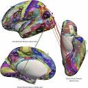 Two what, two where, visual cortical streams in humans - ScienceDirect