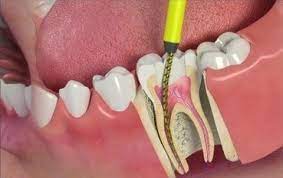 Pin On General Dentistry
