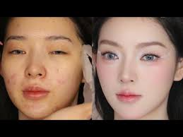 Acne Makeup Tutorial from Chinese Girl Model. Makeup Transformation Get You  Beautiful #acnemakeup
