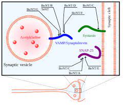 Complications and adverse reactions with the use of botulinum toxin. Botulinum Toxin Wikipedia
