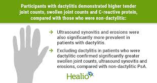 Image result for Dactylitis