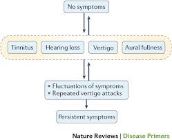 Meniere S Disease Nature Reviews Disease Primers