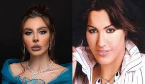 شيماء علي بعد عمليات التجميل. Ù…Ø´ØªØ±ÙƒØ§Øª Ø³ØªØ§Ø± Ø£ÙƒØ§Ø¯ÙŠÙ…ÙŠ ØªØ­Ùˆ Ù„Ù† Ø¨Ø§Ù„ÙƒØ§Ù…Ù„ Ø¨Ø¹Ø¯ Ø¹Ù…Ù„ÙŠØ§Øª Ø§Ù„ØªØ¬Ù…ÙŠÙ„