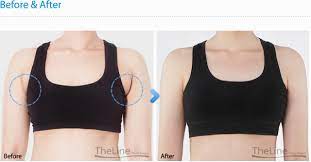 Contohnya, kista, jangkitan atau pertumbuhan lemak mungkin terasa lembut. D A R I B I N T A N G Ketulan Di Bawah Ketiak