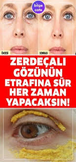 Zerdecali Gozlerinin Etrafina Surenler Bir Daha Vazgecmiyor Zerdecal Cilt Rengi Cilt Bakimi