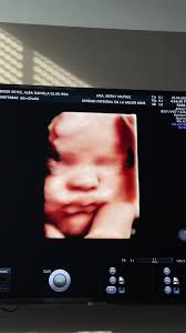 Hola mamita @Daniela Ferrer , soy yo, tu Lyla 💕 Estoy aquí en tu  barriguita, creciendo con todo el amor que me das 💜 Solo quiero decirte  que te amo con todo mi corazoncito, gracias por ser la mejor ...