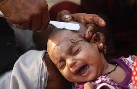 One symptom of biotin deficiency can be thinning hair or discoloration of hair. Is Mundan Helpful In Hair Growth In Babies