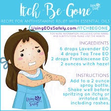 Itch Be Gone Recipe For Antihistamine Relief With Essential Oils Using Essenti Essential Oils For Kids Are Essential Oils Safe Essential Oils For Psoriasis