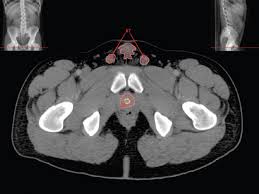 The video covers the most. Pelvis And Abdomen Radiology Key