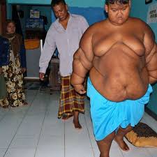 Il révèle la taille peu commune de son organe génital : Indonesie L Operation Reussie De L Enfant Le Plus Gros Du Monde Femme Actuelle Le Mag