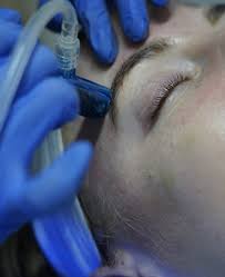 Try out our new procell therapy treatment! Hair Removal Services Medical Spa In Nyc Manhattan Queens