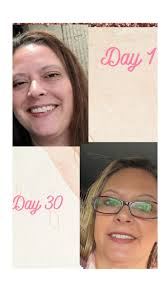 Denise just shared her collagen results. Here are her words: “I've been  pretty quiet about my Collagen results but I still can't stop smiling about  them 😃 Started Jan 2022 and today,