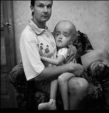 Die nuklearkatastrophe von tschernobyl ereignete sich am 26. 20 Jahre Nach Tschernobyl Nukleare Albtraume Freiburg Fudder De