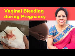 Image result for First Trimester Bleeding