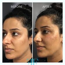 Jill Rinke's Instagram, Twitter & Facebook