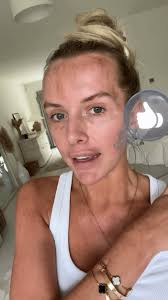 Love Island's Faye Winter bravely shows off her 'real skin' as she reveals  medical condition in bare-faced video