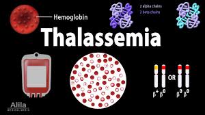 Thalassemia: Alpha & Beta-Thalassemias, Genetics, Pathophysiology,  Diagnosis & Treatment, Animation