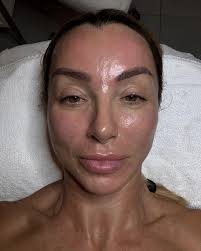 Egzosomi? Svi pričaju o njima... Kod nas su standard u ponudi naprednih  tretmana njege i održavanja vašeg lica💯