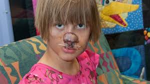 Yes, a raccoon will attack a dog. Raccoon Eats Baby S Face Now 11 She Gets New Ear Abc News