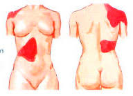 Tratament naturist pentru pietre la fiere. Criza De Colecist Simptome Forum Cabinet De Gastroenterologie Si Hepatologie Bucuresti 0758 751 841